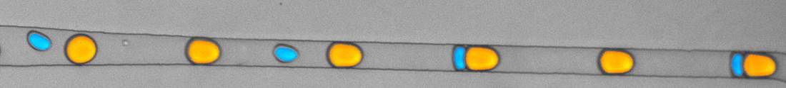 droplet_size_detection